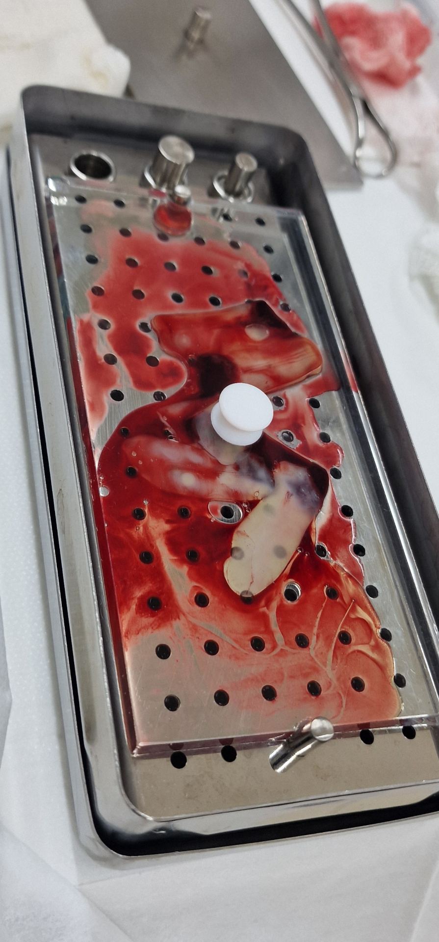 Membranas de PRF preparadas em tabuleiro cirúrgico